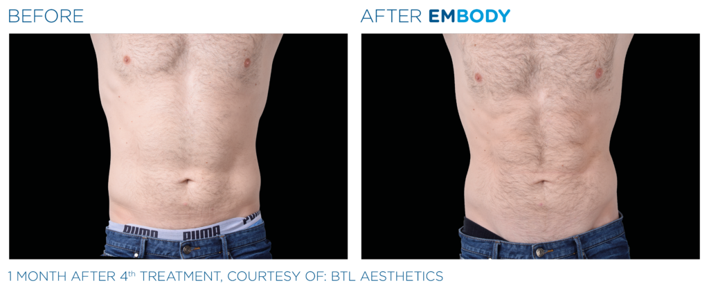 embody efekt1