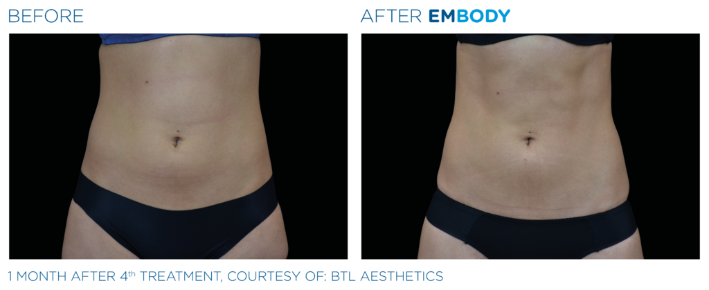 embody efekt2