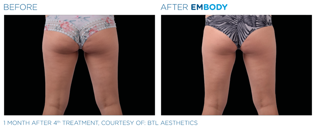 embody efekt3
